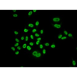 Minichromosome Maintenance Deficient 6 Homolog (MCM6) Antibody