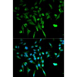 E3 Ubiquitin-Protein Ligase TRIM21 (TRIM21) Antibody