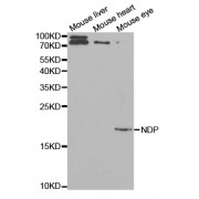 Western blot analysis of extracts of various cell lines, using NDP antibody (abx001600) at 1/1000 dilution.