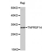Western blot analysis of extracts of Raji cells, using TNFRSF14 antibody (abx001604) at 1/1000 dilution.