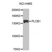 Western blot analysis of extracts of NCI-H460 cells, using PLCB1 antibody (abx001606) at 1/1000 dilution.