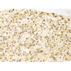 Phospholipase C Beta 1 (PLCB1) Antibody