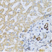 Immunohistochemistry of paraffin-embedded human liver using CSH1 antibody (abx001607) at dilution of 1/100 (40x lens).