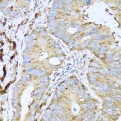 Placental Lactogen (CSH1) Antibody