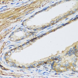 Placental Lactogen (CSH1) Antibody