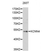 Western blot analysis of extracts of 293T cells, using KCNN4 antibody (abx001608) at 1/1000 dilution.