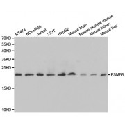 Western blot analysis of extracts of various cell lines, using PSMB5 antibody (abx001609) at 1/1000 dilution.