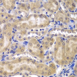 Ribosomal Protein L5 (RPL5) Antibody
