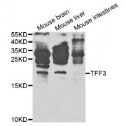 Western blot analysis of extracts of various cell lines, using TFF3 antibody (abx001612) at 1/1000 dilution.