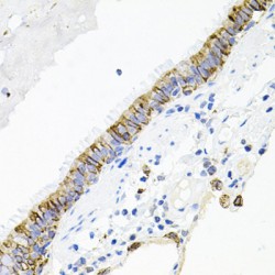 Activin A Receptor Type 2A (ACVR2A) Antibody