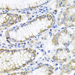 Activin A Receptor Type 2A (ACVR2A) Antibody