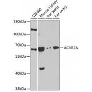 Western blot analysis of extracts of various cell lines, using ACVR2A antibody (abx001614) at 1/1000 dilution.