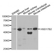 Western blot analysis of extracts of various cell lines, using HSD17B2 antibody (abx001615) at 1/1000 dilution.
