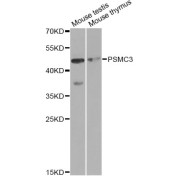 Western blot analysis of extracts of various cell lines, using PSMC3 antibody (abx001618) at 1/1000 dilution.