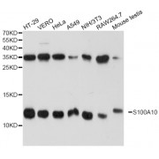 Western blot analysis of extracts of various cell lines, using S100A10 antibody (abx001619) at 1/1000 dilution.