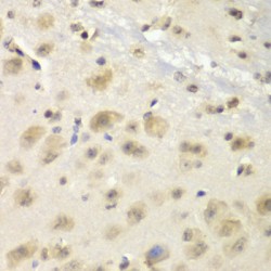 Protein S100-A10 (S100A10) Antibody