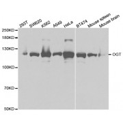 Western blot analysis of extracts of various cell lines, using OGT antibody (abx001621) at 1/1000 dilution.