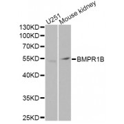 Western blot analysis of extracts of various cell lines, using BMPR1B Antibody (abx001630) at 1/1000 dilution.