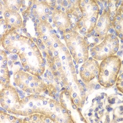 Bone Morphogenetic Protein Receptor 1B (BMPR1B) Antibody