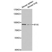 Western blot analysis of extracts of various cell lines, using IFI16 antibody (abx001632) at 1/1000 dilution.