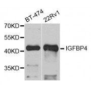 Western blot analysis of extracts of various cell lines, using IGFBP4 antibody (abx001633) at 1/1000 dilution.