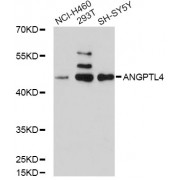 Western blot analysis of extracts of various cell lines, using ANGPTL4 antibody (abx001634) at 1/1000 dilution.