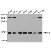 Western blot analysis of extracts of various cell lines, using RPS19 antibody (abx001639) at 1/1000 dilution.