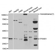 Western blot analysis of extracts of various cell lines, using TPSAB1 antibody (abx001641) at 1/200 dilution.