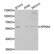 Western blot analysis of extracts of various cell lines, using KPNA4 antibody (abx001643) at 1/1000 dilution.