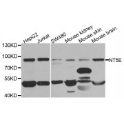 Western blot analysis of extracts of various cell lines, using NT5E antibody (abx001646) at 1/1000 dilution.