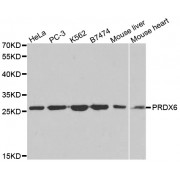 Western blot analysis of extracts of various cell lines, using PRDX6 antibody (abx001648) at 1/1000 dilution.