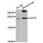 Western blot analysis of extracts of various cell lines, using CD70 antibody (abx001649) at 1/1000 dilution.