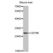 Western blot analysis of extracts of mouse liver, using CD79B antibody (abx001650) at 1/1000 dilution.