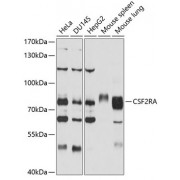 Western blot analysis of extracts of various cell lines, using CSF2RA antibody (abx001651) at 1/1000 dilution.
