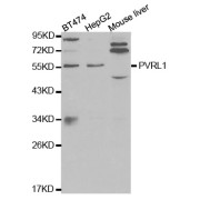 Western blot analysis of extracts of various cell lines, using PVRL1 antibody (abx001654) at 1/1000 dilution.