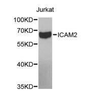 Western blot analysis of extracts of Jurkat cells, using ICAM2 antibody (abx001655) at 1/1000 dilution.