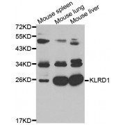 Western blot analysis of extracts of various cell lines, using KLRD1 antibody (abx001656) at 1/1000 dilution.