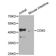 Western blot analysis of extracts of various cell lines, using CD83 antibody (abx001657) at 1/1000 dilution.