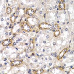 Cluster of Differentiation 83 (CD83) Antibody
