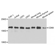 Western blot analysis of extracts of various cell lines, using CD69 antibody (abx001662) at 1/1000 dilution.