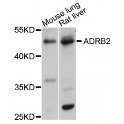 Western blot analysis of extracts of various cell lines, using ADRB2 antibody (abx001665) at 1/1000 dilution.