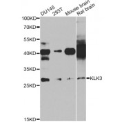 Western blot analysis of extracts of various cell lines, using KLK3 antibody (abx001669) at 1/1000 dilution.