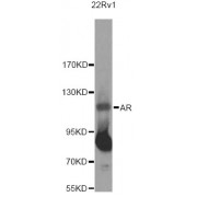 Western blot analysis of extracts of 22RV1 cells, using AR Antibody (abx001670) at 1/500 dilution.
