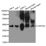 Western blot analysis of extracts of various cell lines, using CAPZA2 antibody (abx001671) at 1/1000 dilution.