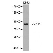 Western blot analysis of extracts of K-562 cells, using CCNT1 antibody (abx001674).