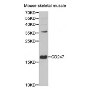 Western blot analysis of extracts of mouse skeletal muscle, using CD247 antibody (abx001675) at 1/1000 dilution.