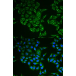 T-Cell Surface Glycoprotein CD3 Zeta Chain (CD247) Antibody