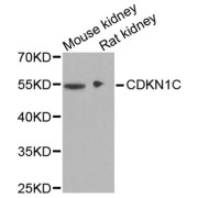 Western blot analysis of extracts of various cell lines, using CDKN1C antibody (abx001677) at 1/1000 dilution.