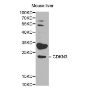 Western blot analysis of extracts of mouse liver, using CDKN3 antibody (abx001678) at 1/1000 dilution.