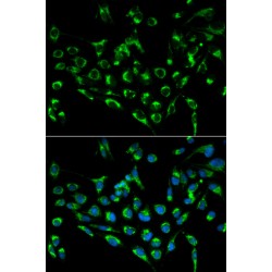 Cyclin Dependent Kinase Inhibitor 3 (CDKN3) Antibody